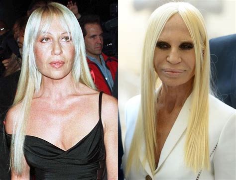 donatella versace pictures before and after|donatella versace plastic surgery 2022.